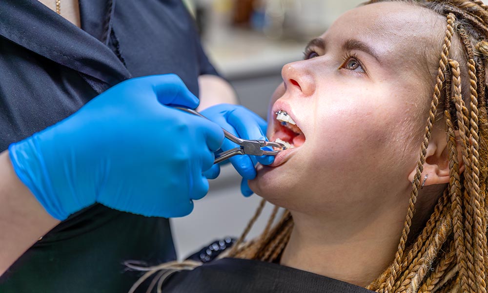 surgical tooth extraction