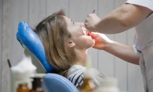 wisdom teeth removal perth,